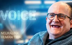 Un cip Neuralink redă vorbirea unui pacient cu ALS