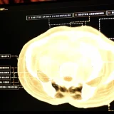 Midjourney trece de la generarea de imagini AI la dezvoltarea de dispozitive medicale