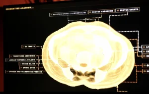 Midjourney trece de la generarea de imagini AI la dezvoltarea de dispozitive medicale
