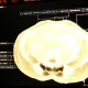 Midjourney trece de la generarea de imagini AI la dezvoltarea de dispozitive medicale